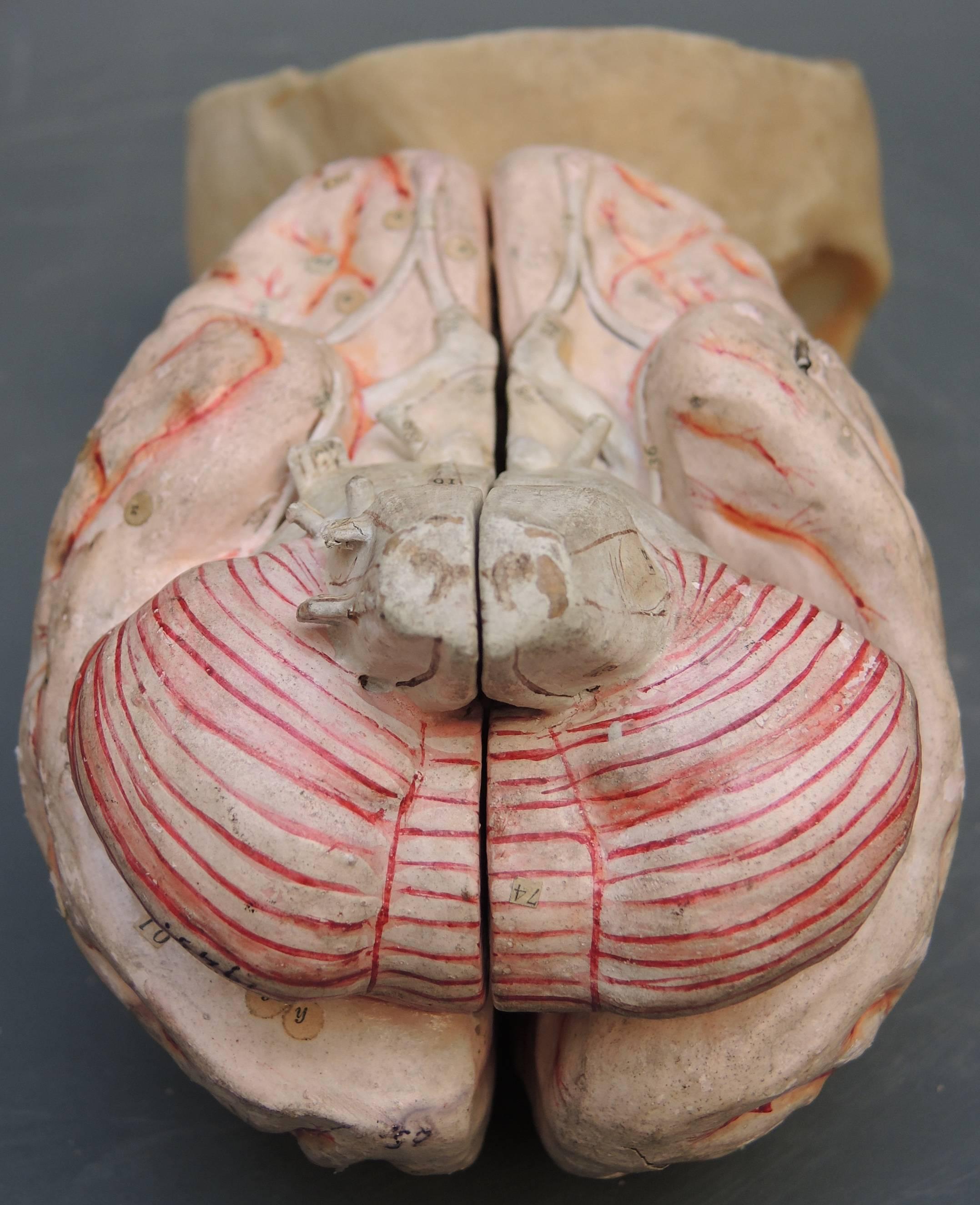 An extremely rare papier mâché model of the brain in a resin skull. Signed and dated Dr. Auzoux 1949. All original parts fully intact including the hand applied tags referring to the various parts. Completely hand-painted in extremely fine detail