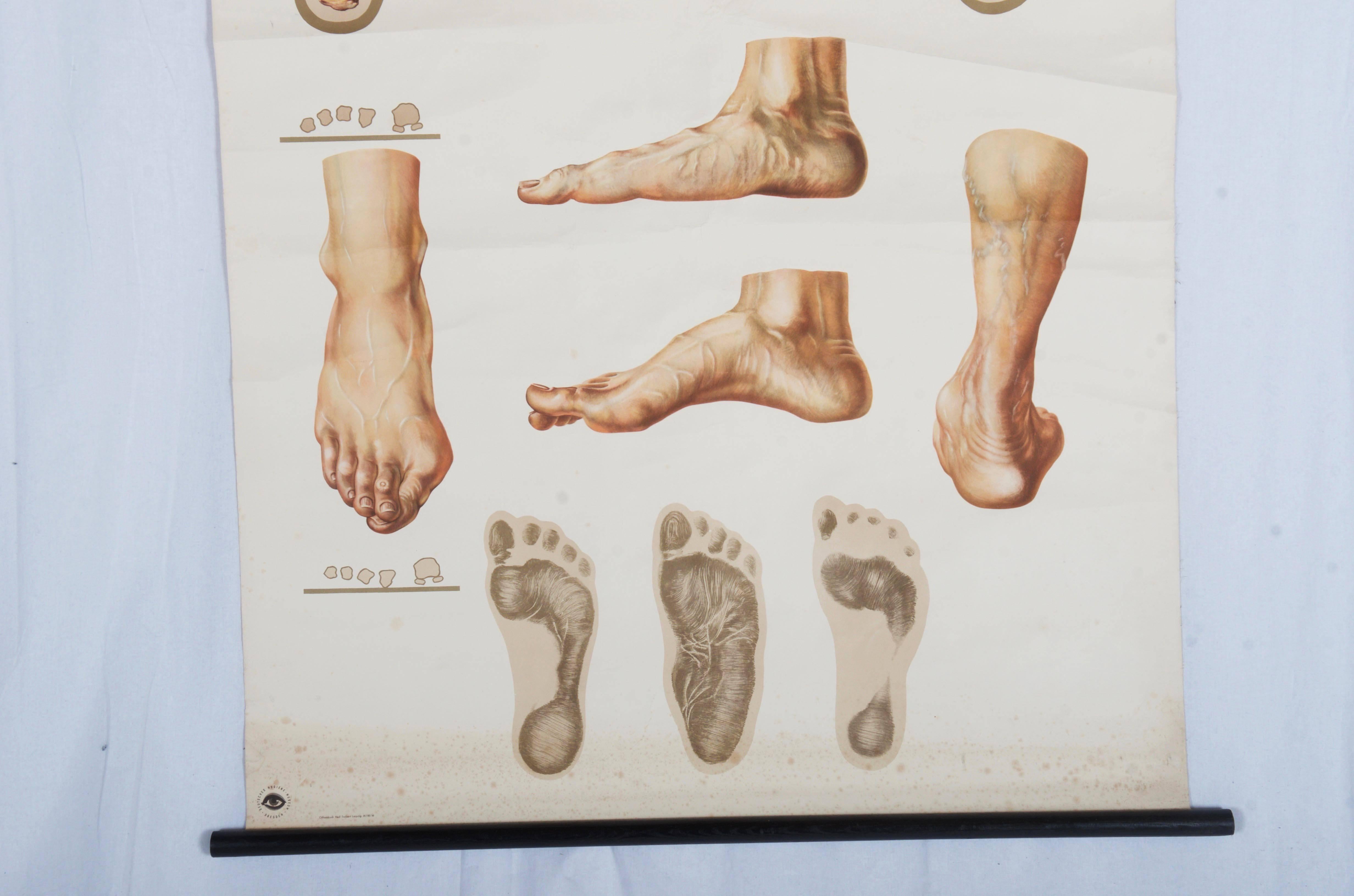 Große deutsche medizinische Charte im Vintage-Stil, Poster „Orthopedie des Fußes“ (Bauhaus) im Angebot