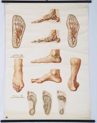 Vintage Large German Medical Chart, Poster "Orthopedics of Foot"