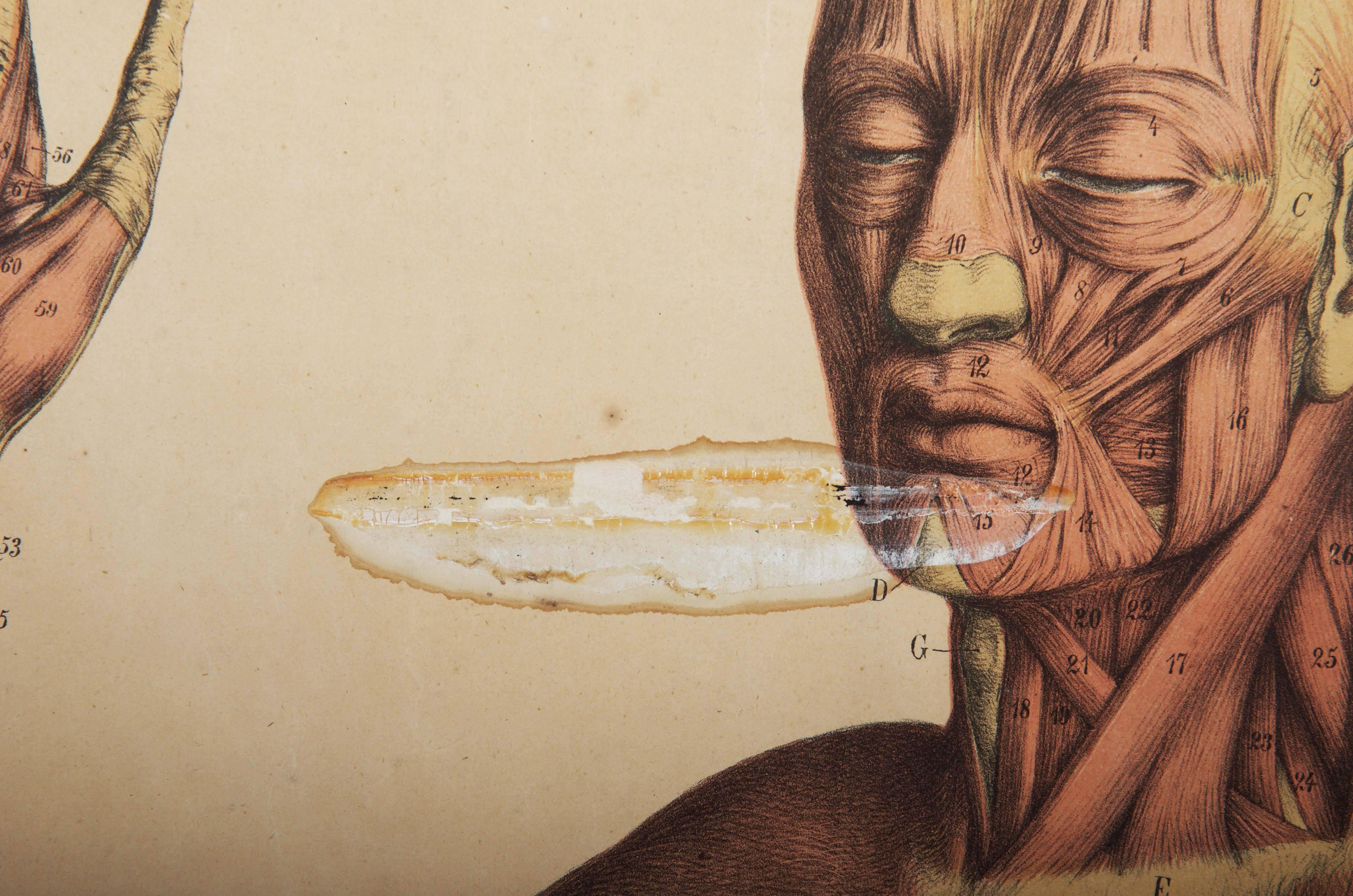 Grafico da parete raffigurante i muscoli umani.
Probabilmente risale agli anni '50 del XIX secolo. Stampato in Germania per le scuole svedesi.
Stampa colorata su carta.
Buone condizioni originali, tracce d'uso dovute all'età.
