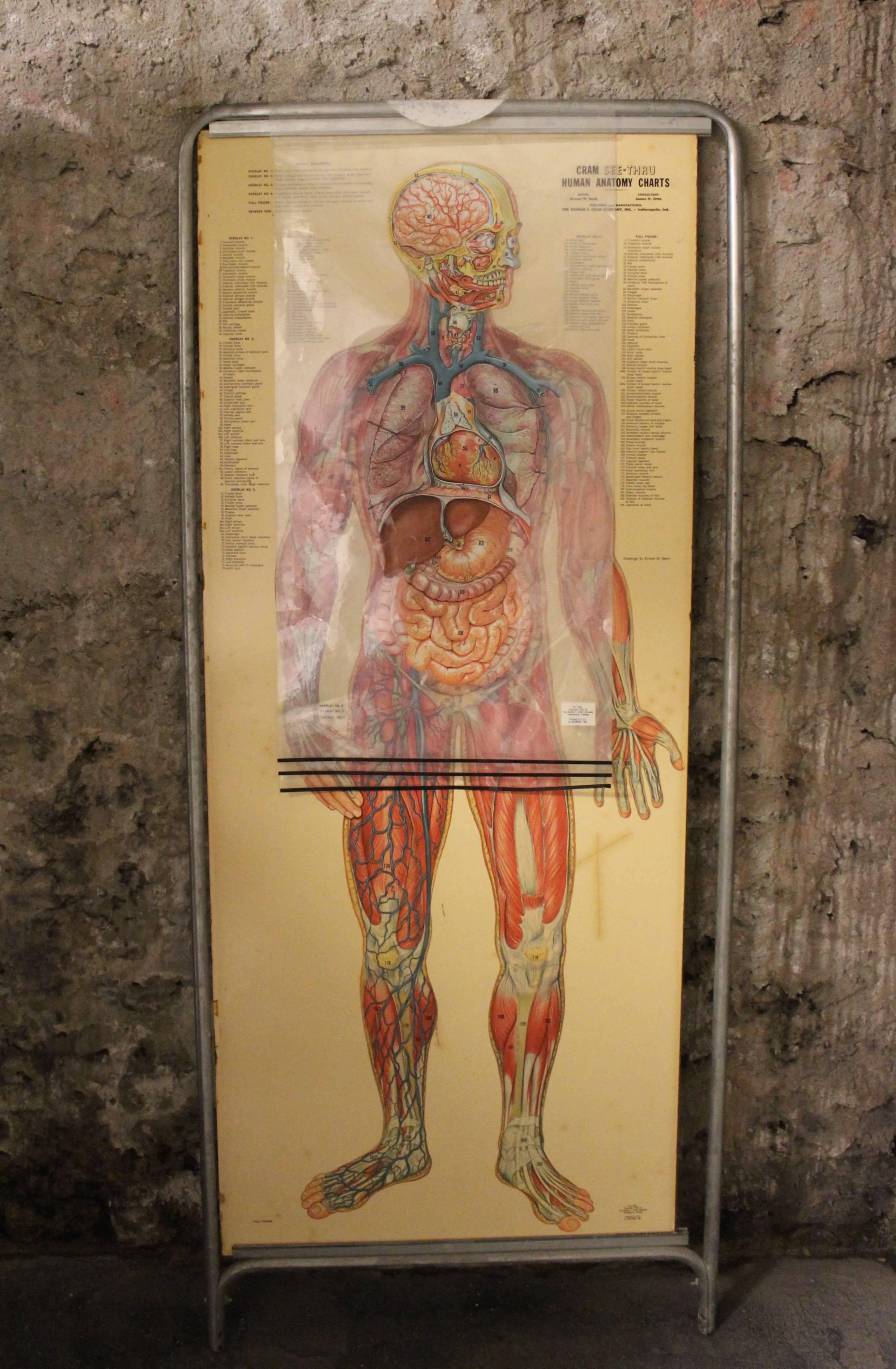 Américain Échantillon d'anatomie médicale intitulé « Tin Man » en vente