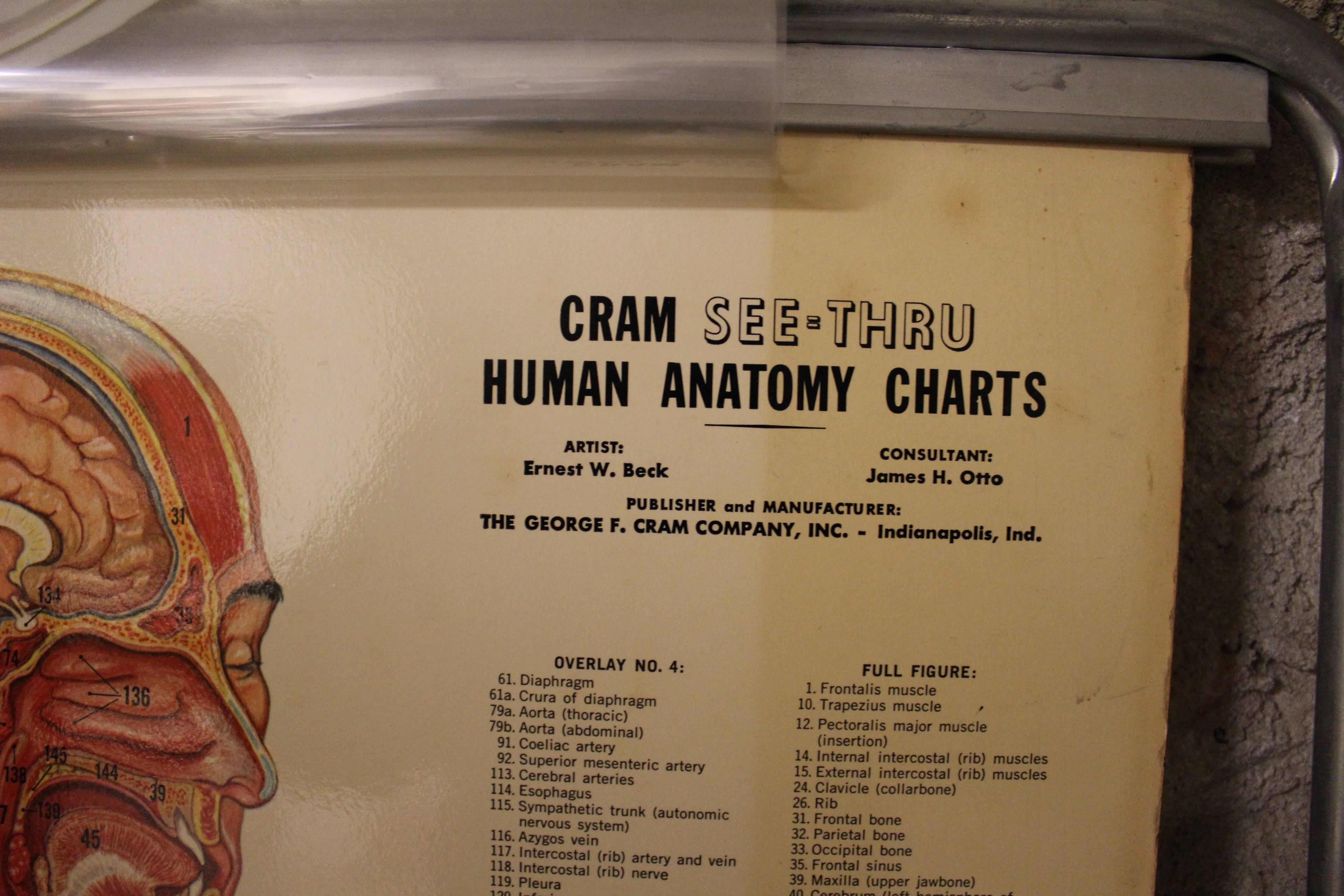 Échantillon d'anatomie médicale intitulé « Tin Man » en vente 2