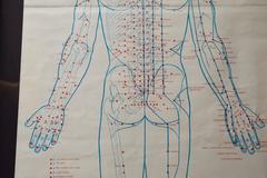 Set of Five Large 1970s Acupuncture Charts