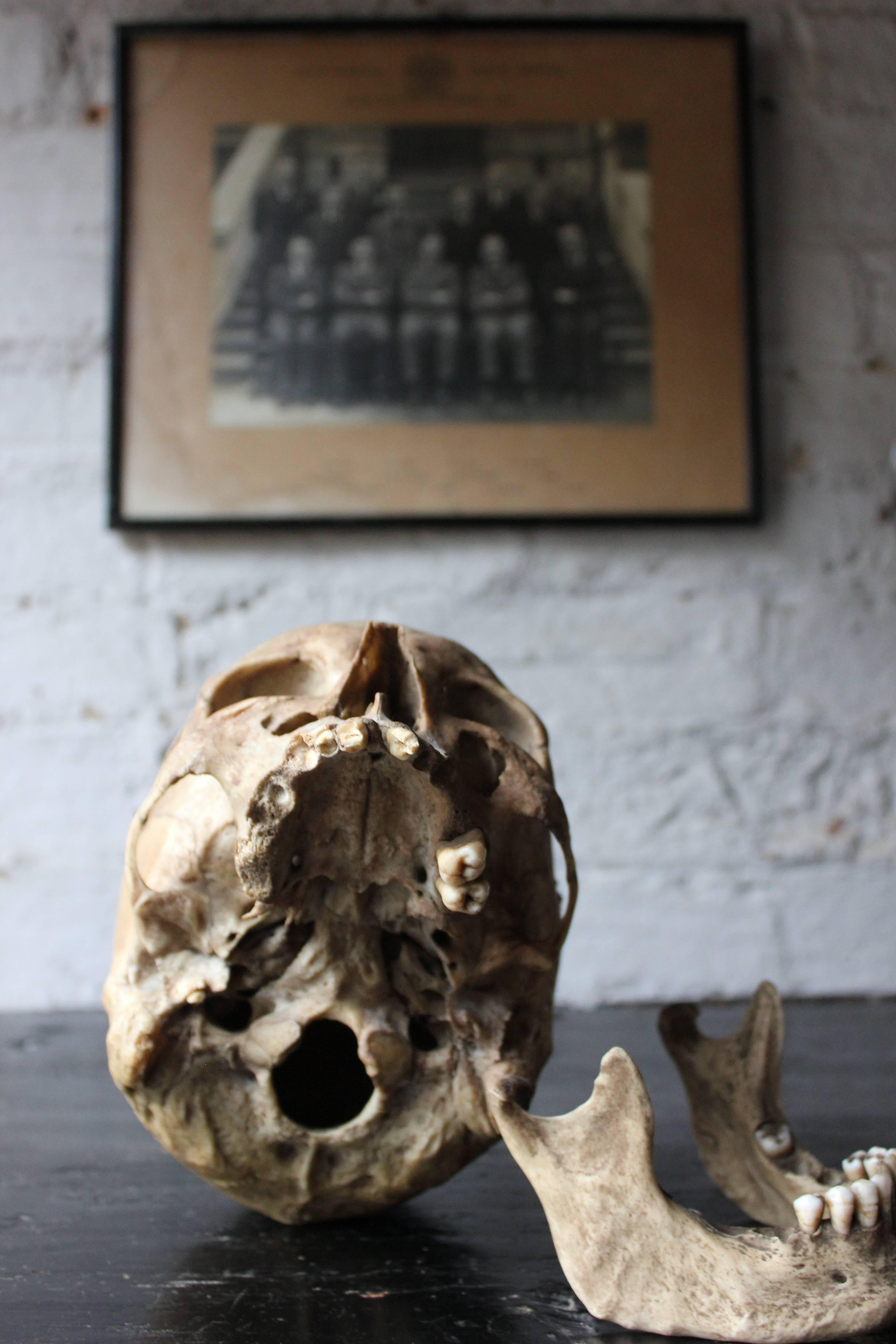The largely in-tact human skull dating to at least the early twentieth century, having bee used for odontology and medical study together with a black and white photograph of Guy's Hospital Dental School House Officers, taken in November