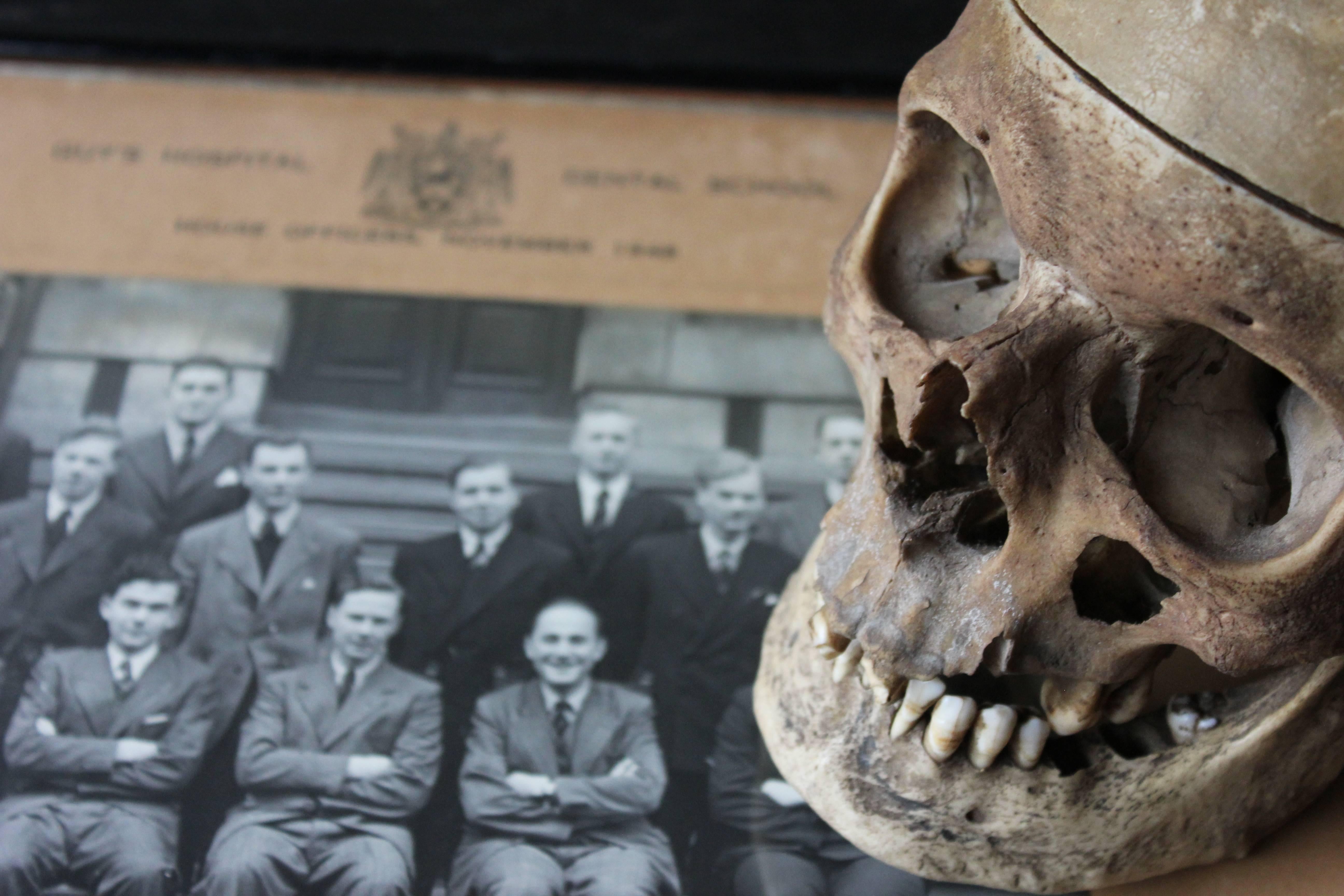 Early 20thc Human Skull for Odontology and Medical Study from Guy's Hospital 2