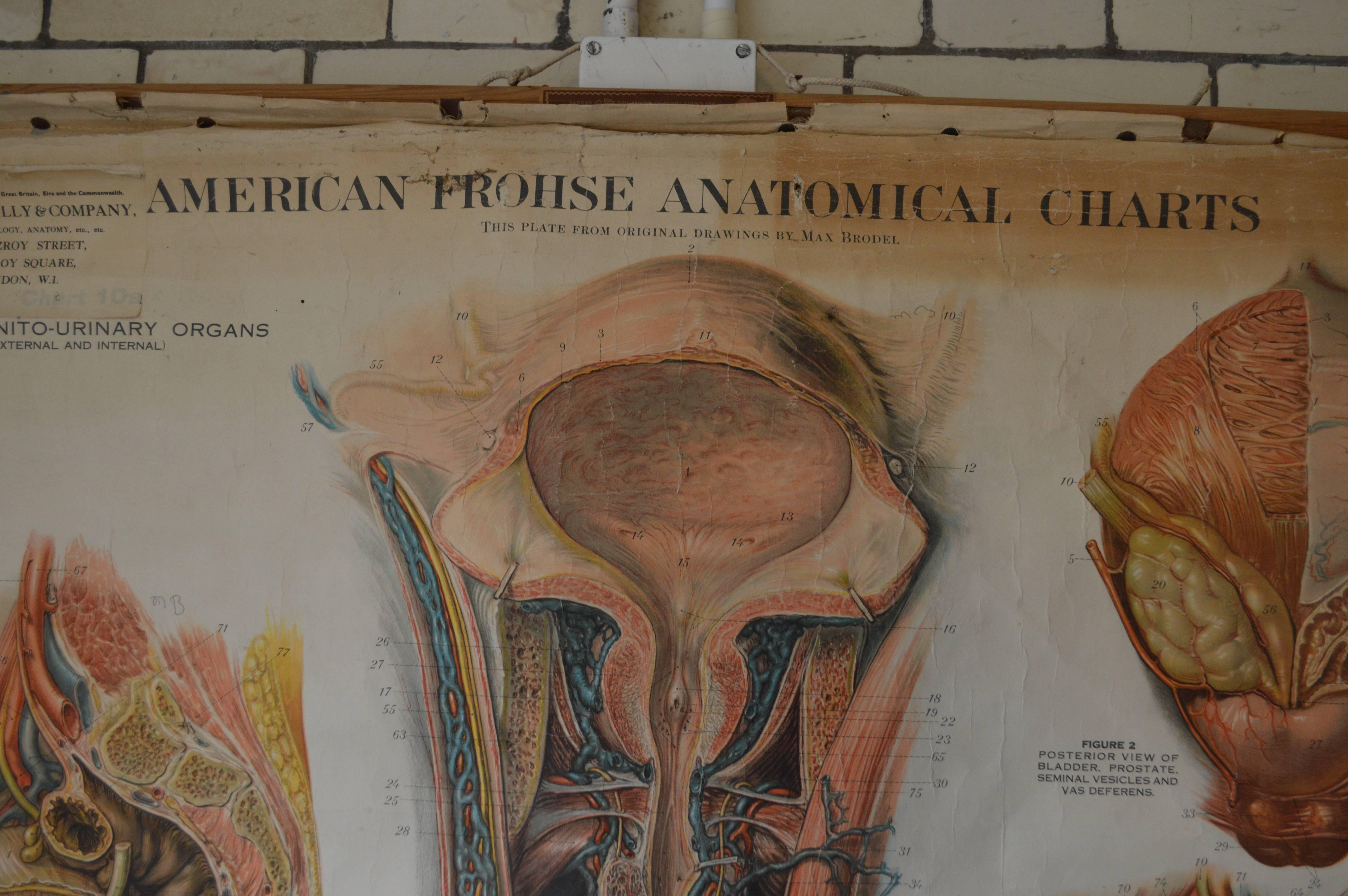 This is a highly collectible Max Brödel, American Frohse anatomical wall chart illustrating the male and female Genito-Urinary functions. The chart also has a wonderful sticker indicating that the chart was distributed in the early to mid-part of