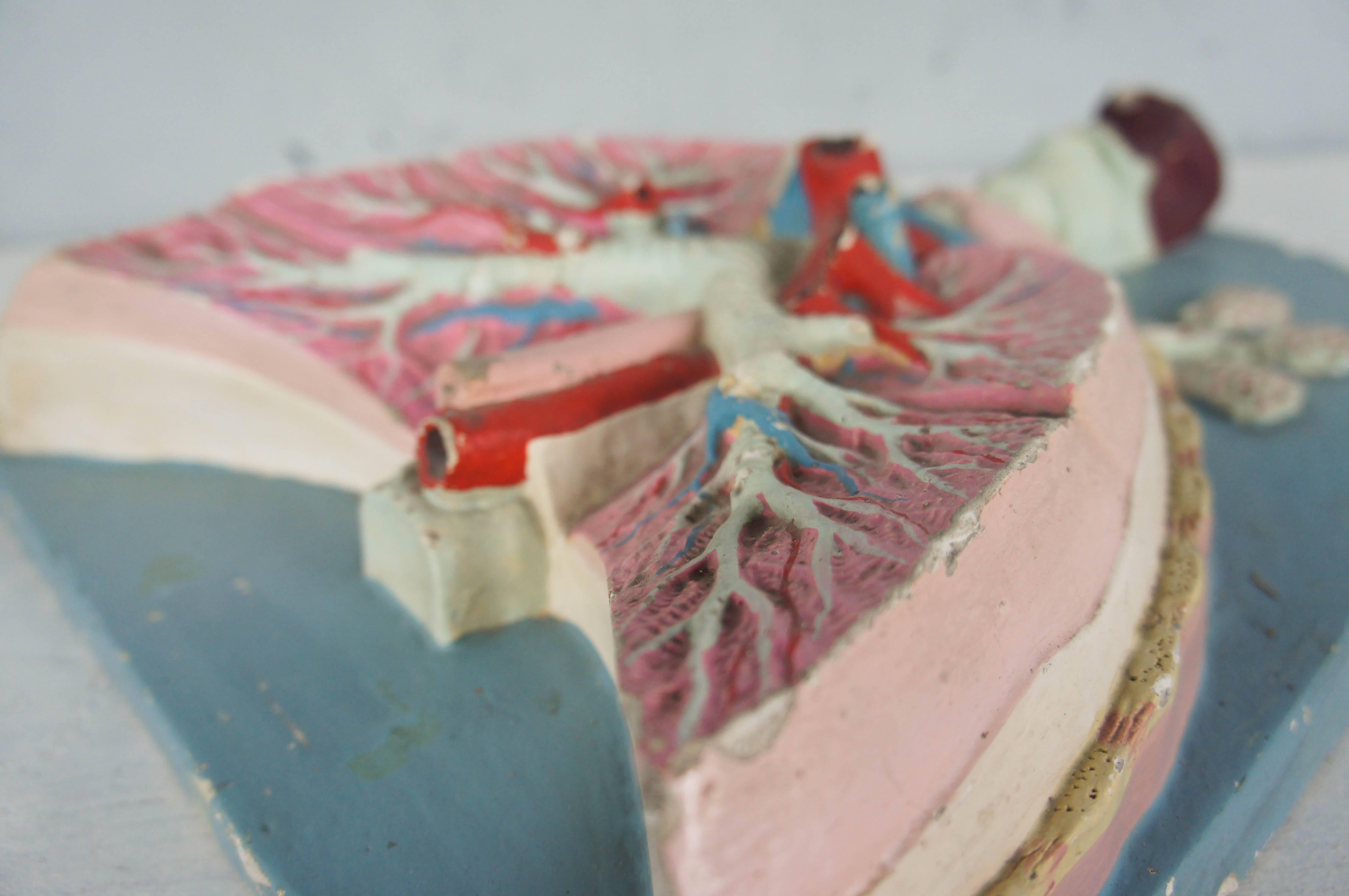 20th Century Painted Plaster Human Anatomy Model of Lungs 1
