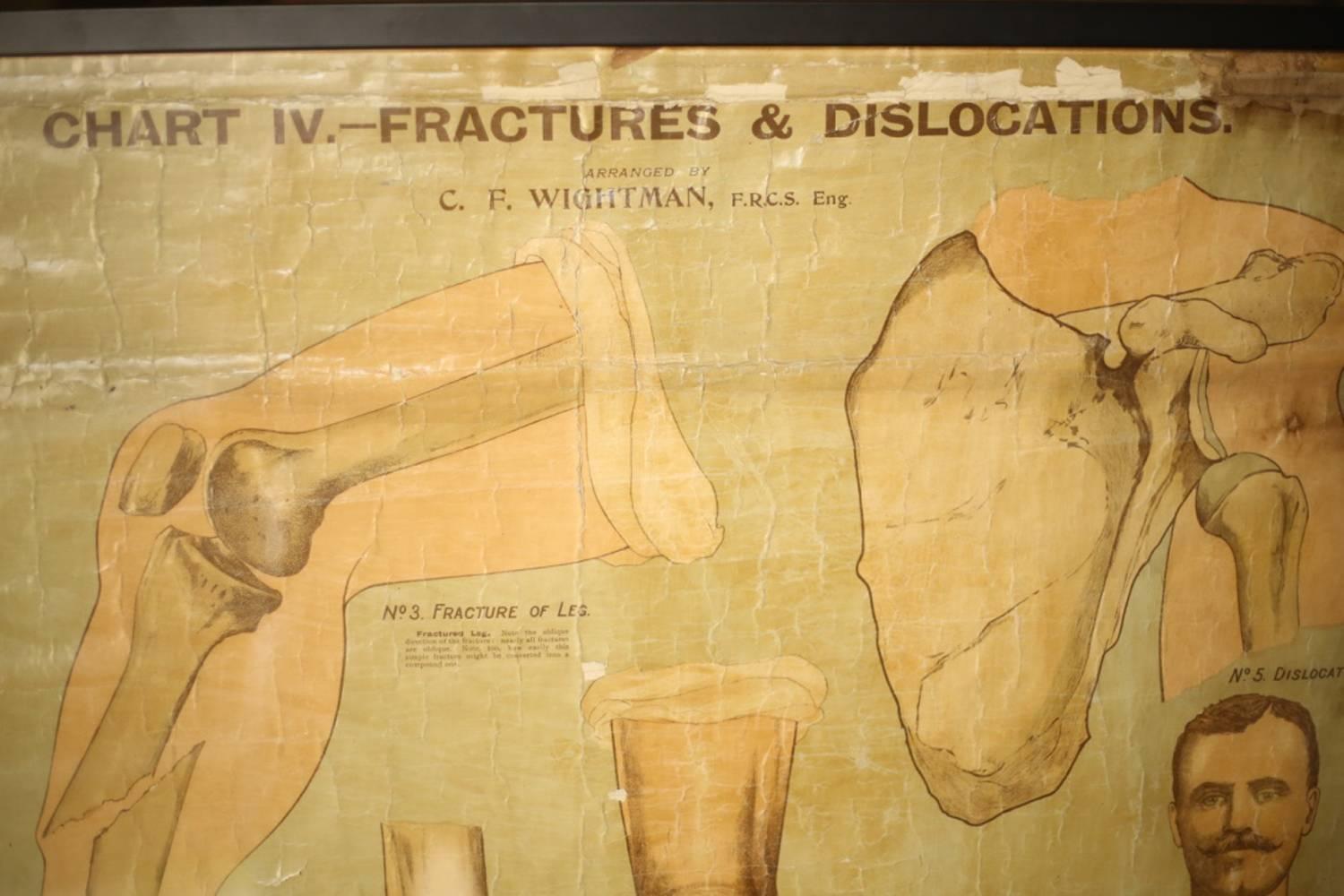 Edwardian Medical Poster of Fractures and Dislocations, Chemist Science 3
