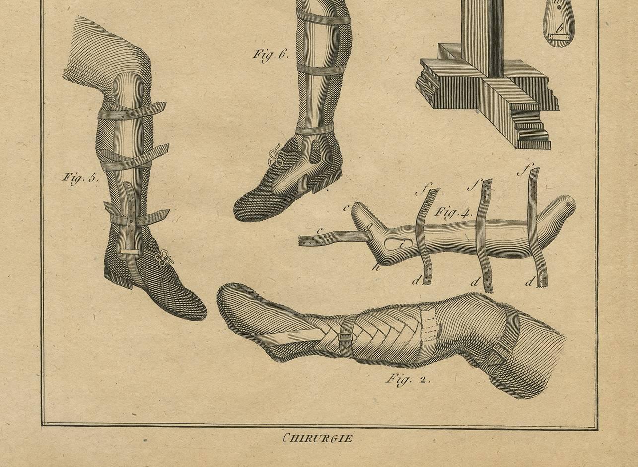 Stampa antica di Tecniche di chirurgia delle gambe di H. Agasse, 1798 circa In condizioni buone in vendita a Langweer, NL