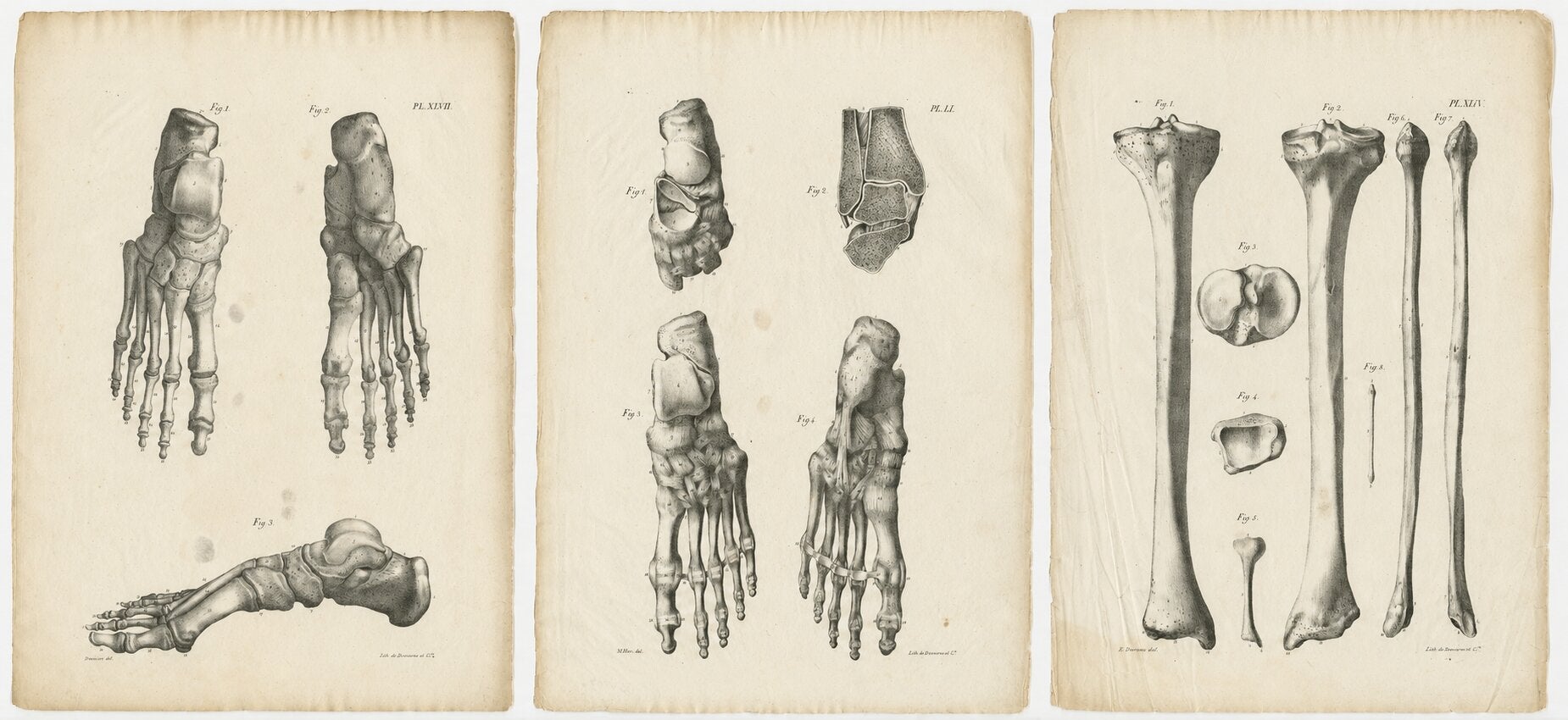 Set of Three Original French Anatomical Foot and Lower Limb Lithographs, 1821