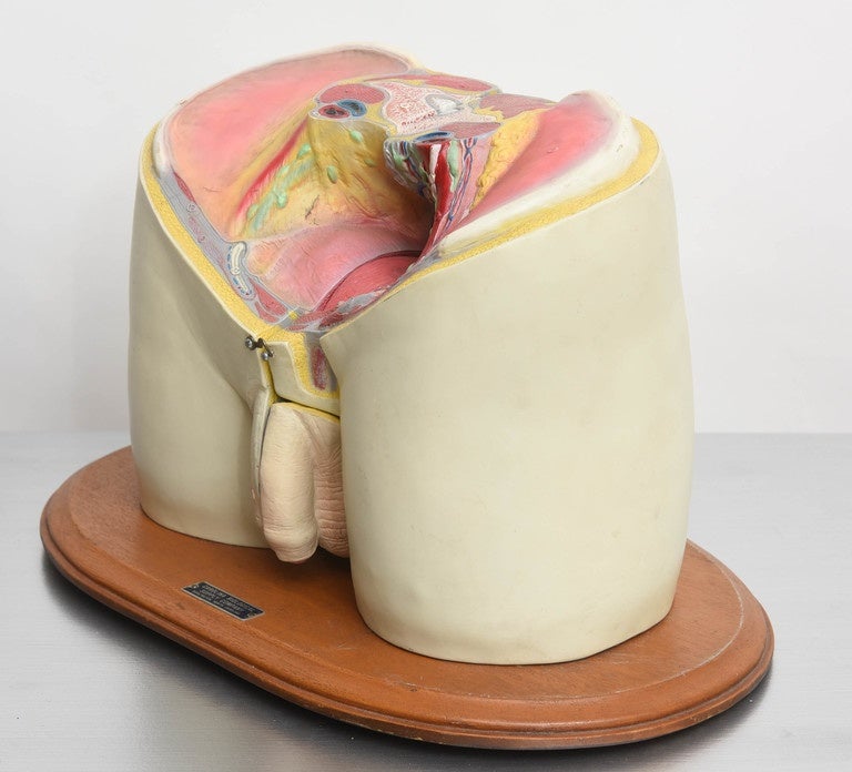 Medical training display of anatomical penis that opens to split section. By Carolina Biological Supply Company.