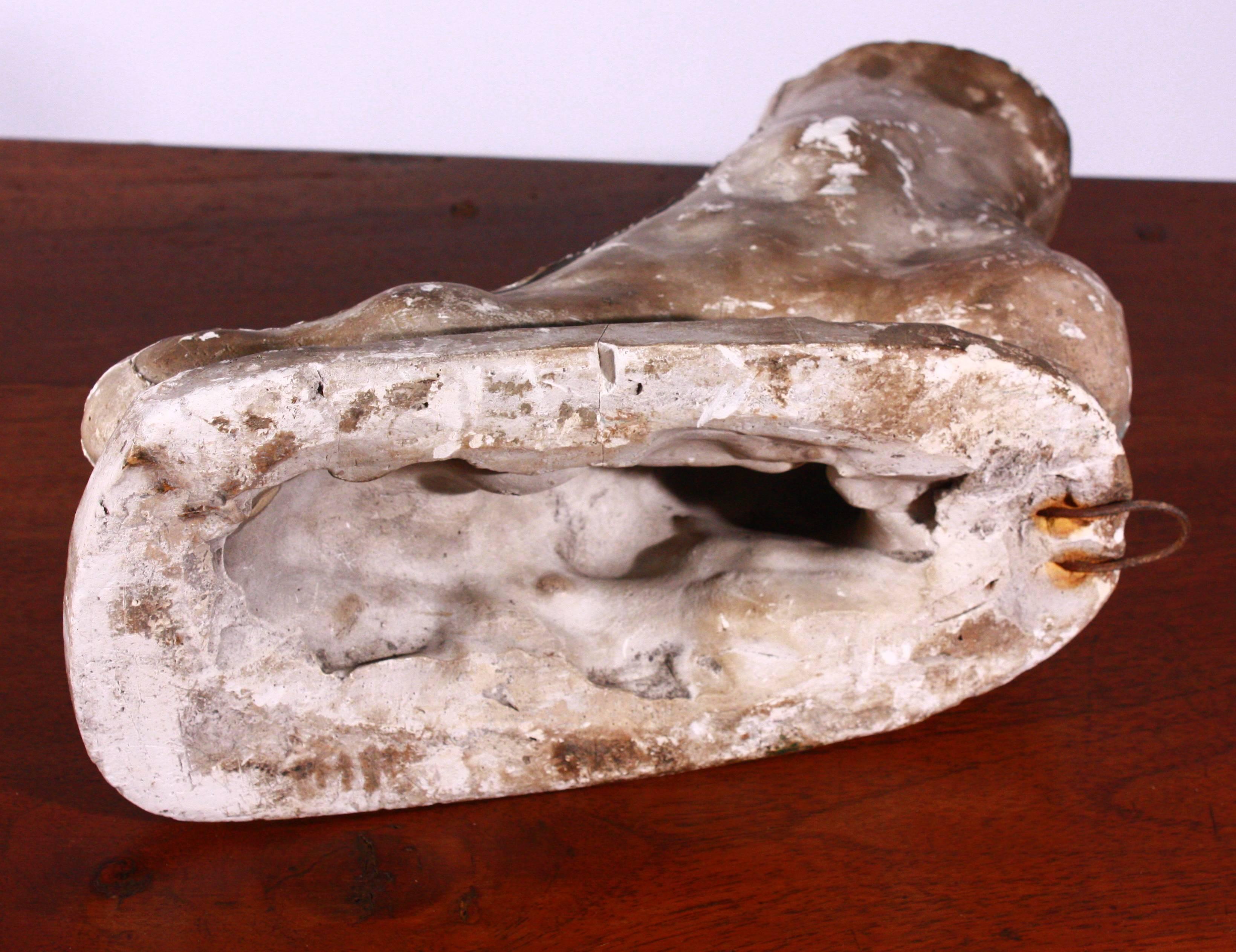 plaster cast foot