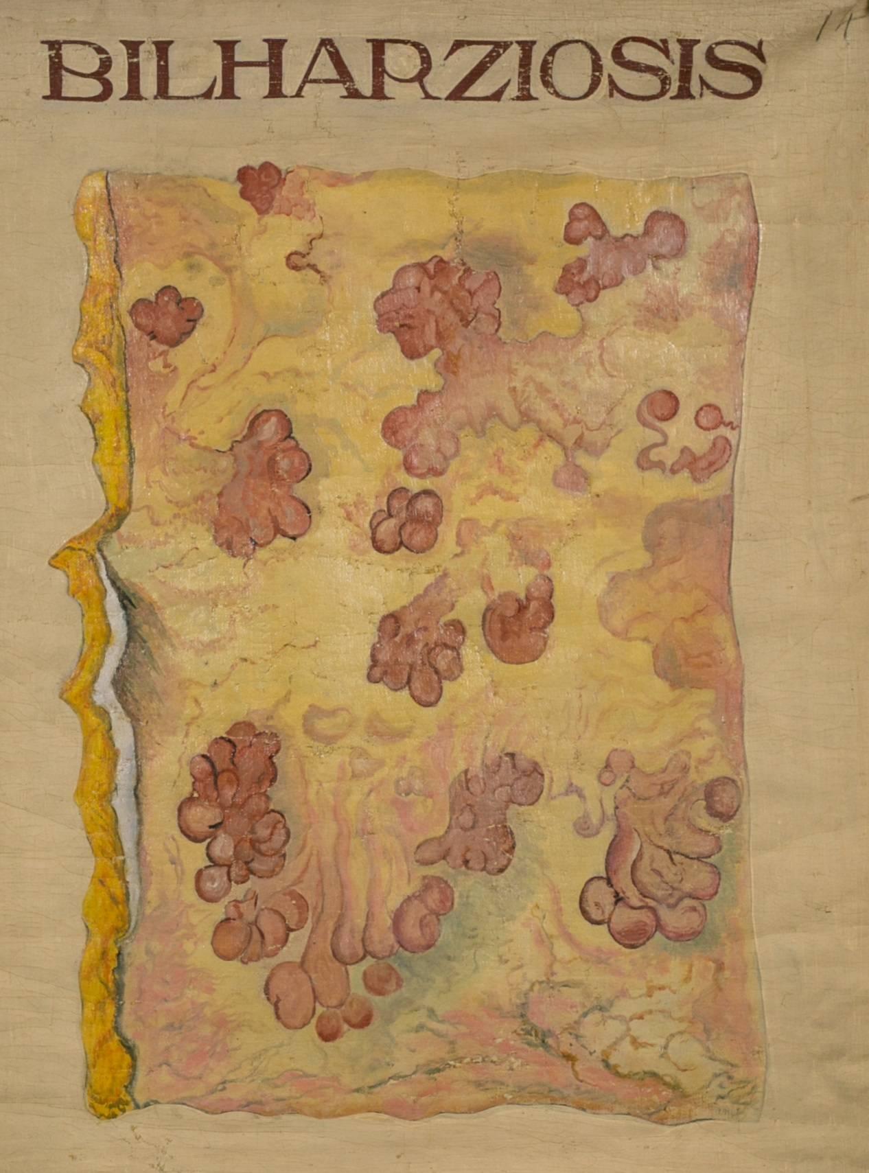 Early 20th Century Set of Three Hand-Painted Teaching Charts of Aquatic Parasites and Diseases