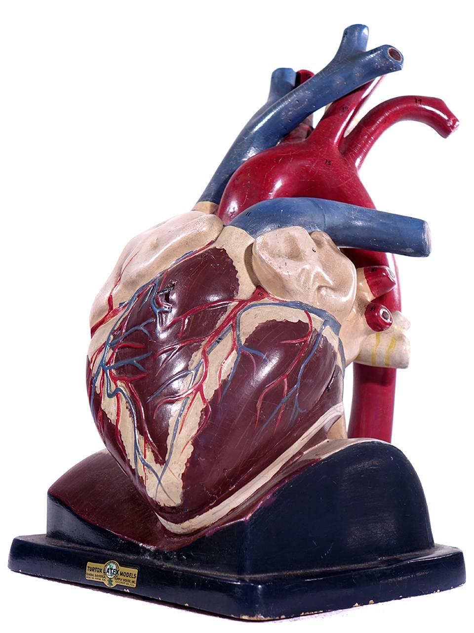Oversized Break Away Anatomical Model of the Heart by Trutox