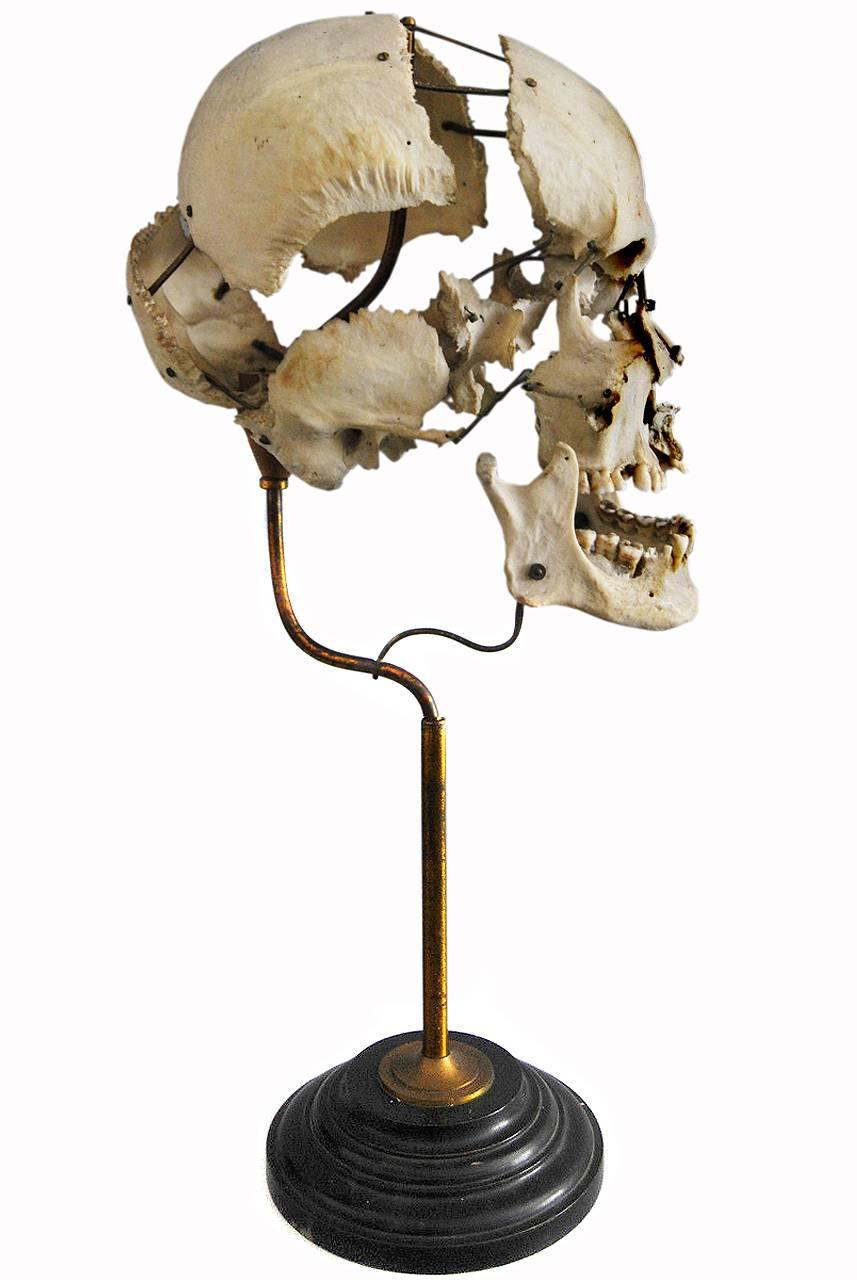 exploded skull display