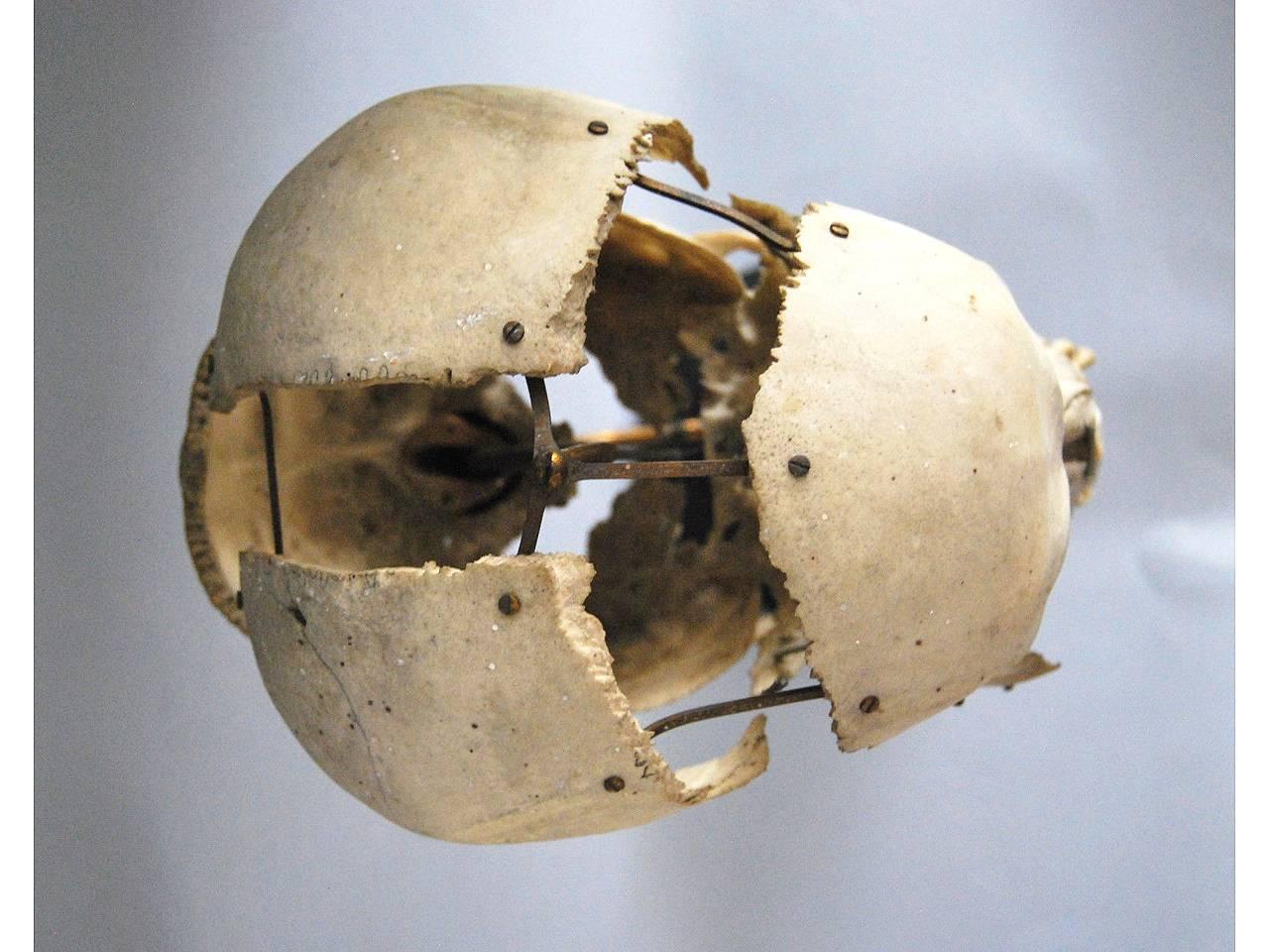Industrial Real Beauchene Skull, Early Medical School Teaching Display