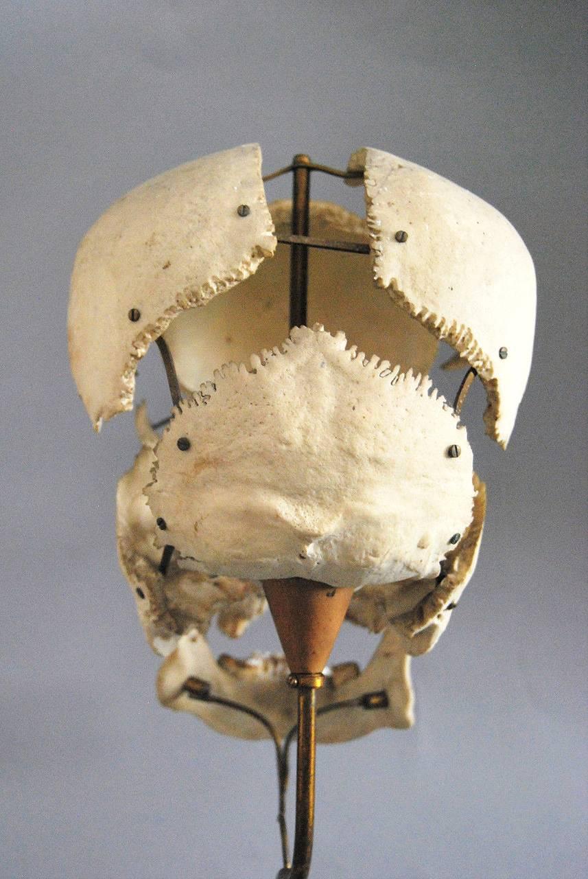 French Real Beauchene Skull, Early Medical School Teaching Display
