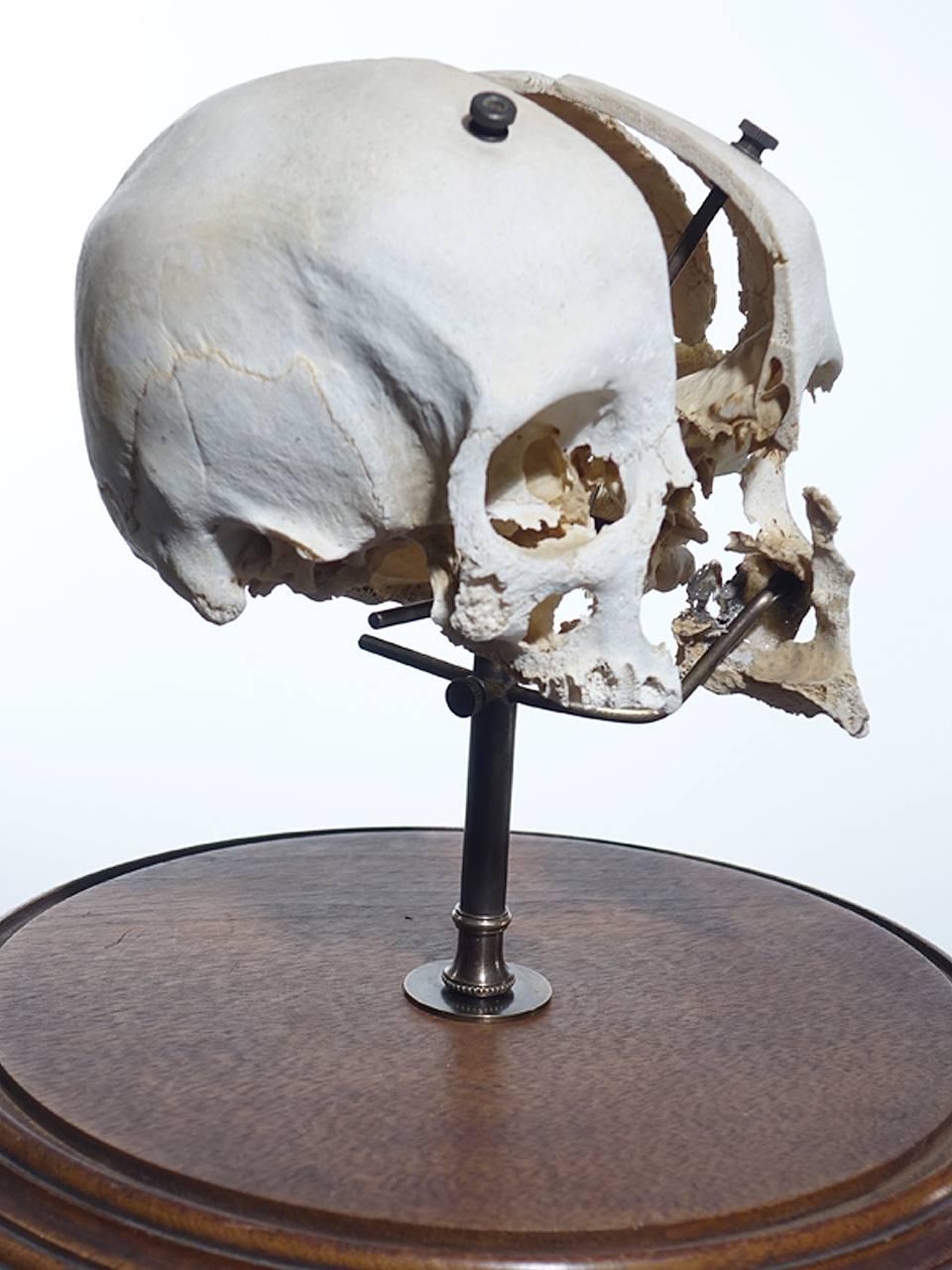 Industrial Real Beauchene Skull, Medical School Teaching Display