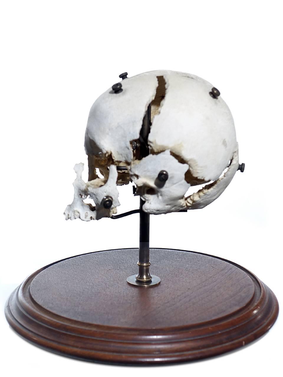 Unknown Real Beauchene Skull, Medical School Teaching Display