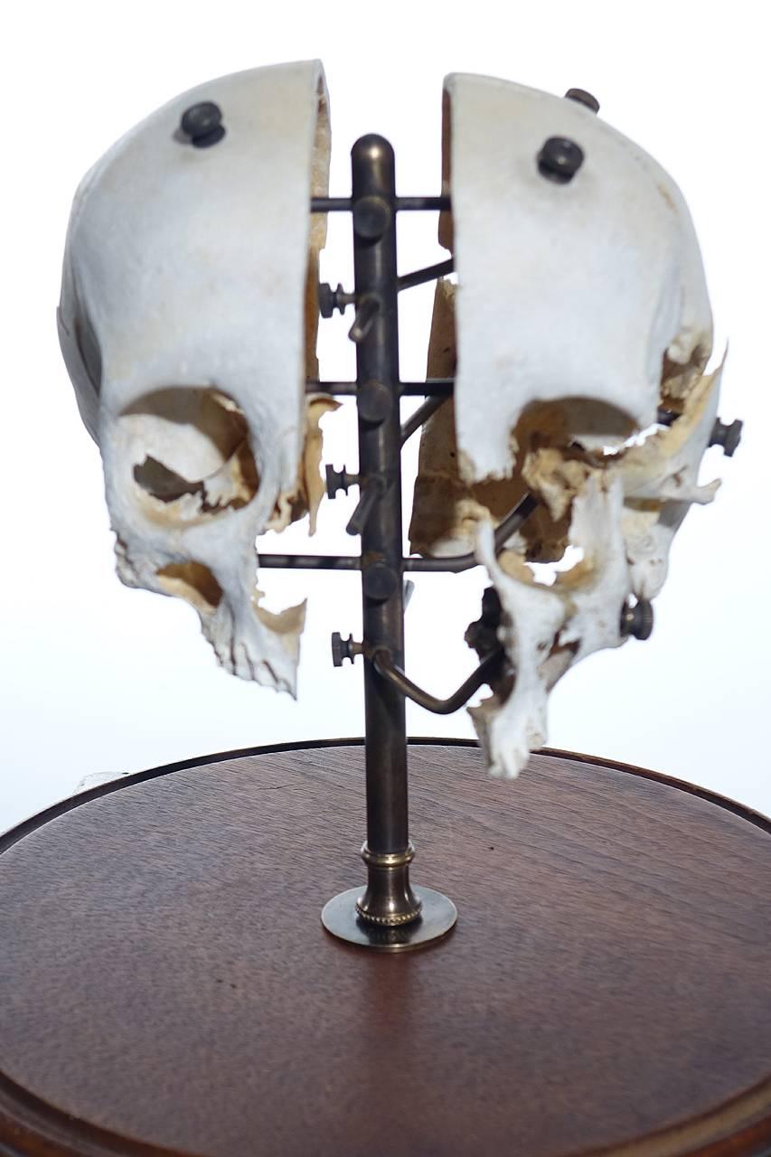 Real Beauchene Skull, Medical School Teaching Display In Excellent Condition In Peekskill, NY