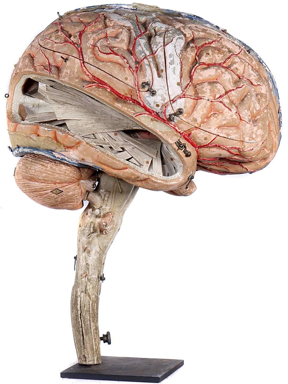 This fantastically detailed double sized 19th century papier mâché model of the brain dates to the mid-19th century. It was made by Dr. Auzoux and listed in his catalogue. The attention to detail is breathtaking and this includes the anatomical