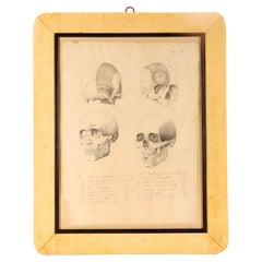 Anatomical drawing of four views of a skull with muscle bands, Italy 1890.
