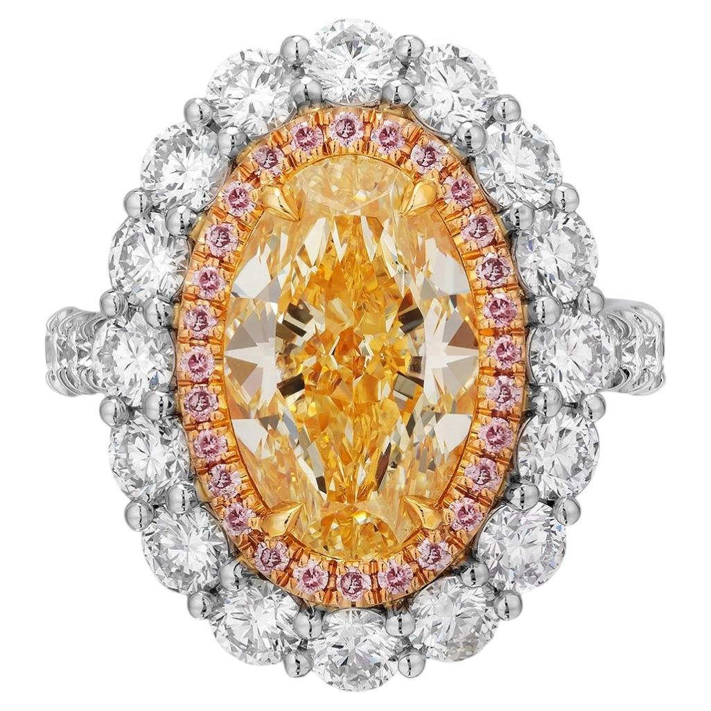 What is a diamond bypass ring?