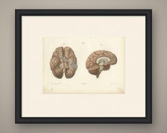 Arteries of the Brain, Antique Hirschfeld Anatomy Print, 1866