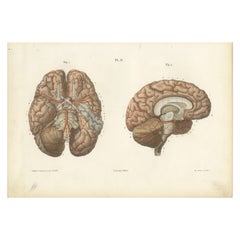 Arteries of the Brain, Antique Hirschfeld Anatomy Print, 1866