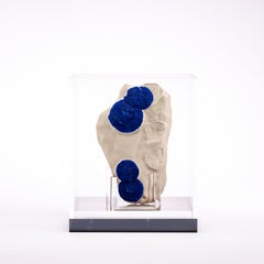 Australian Blue Azurite Sun Specimen in Acrylic Custom Box