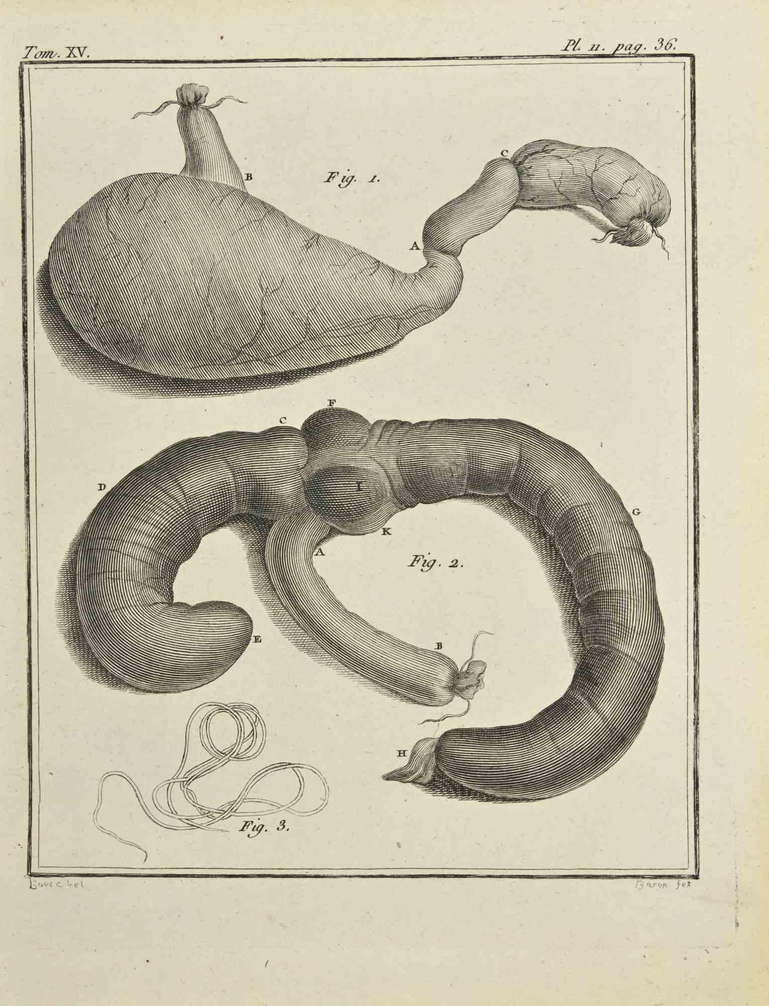Institutiones Chirurgicae - Gravure de Bernard Baron - 1771