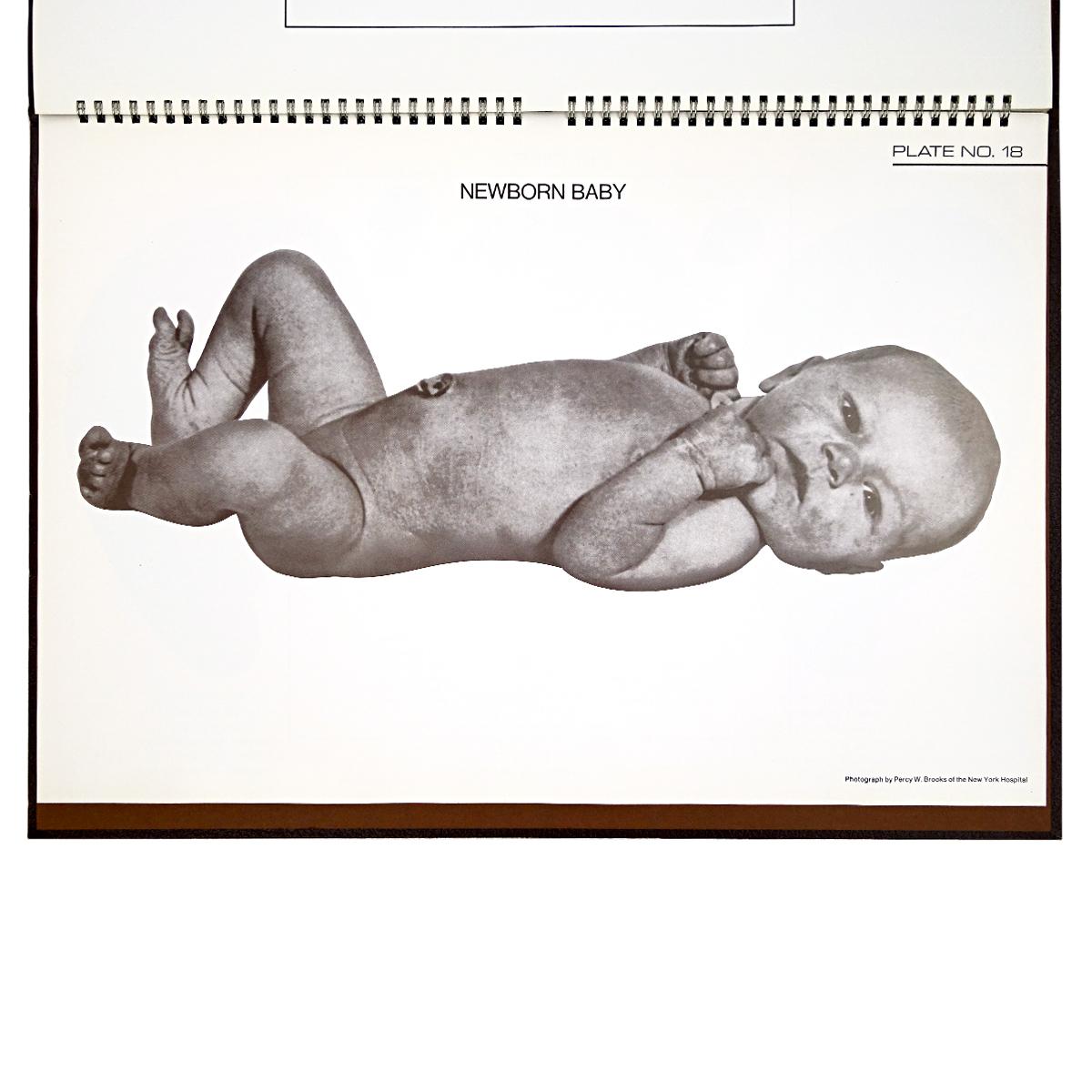 Birth Atlas by the Maternity Center Association in New York 1