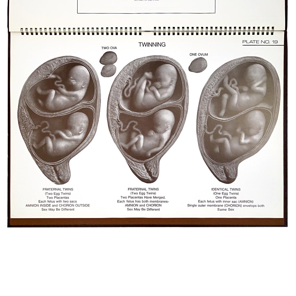 Birth Atlas by the Maternity Center Association in New York 2
