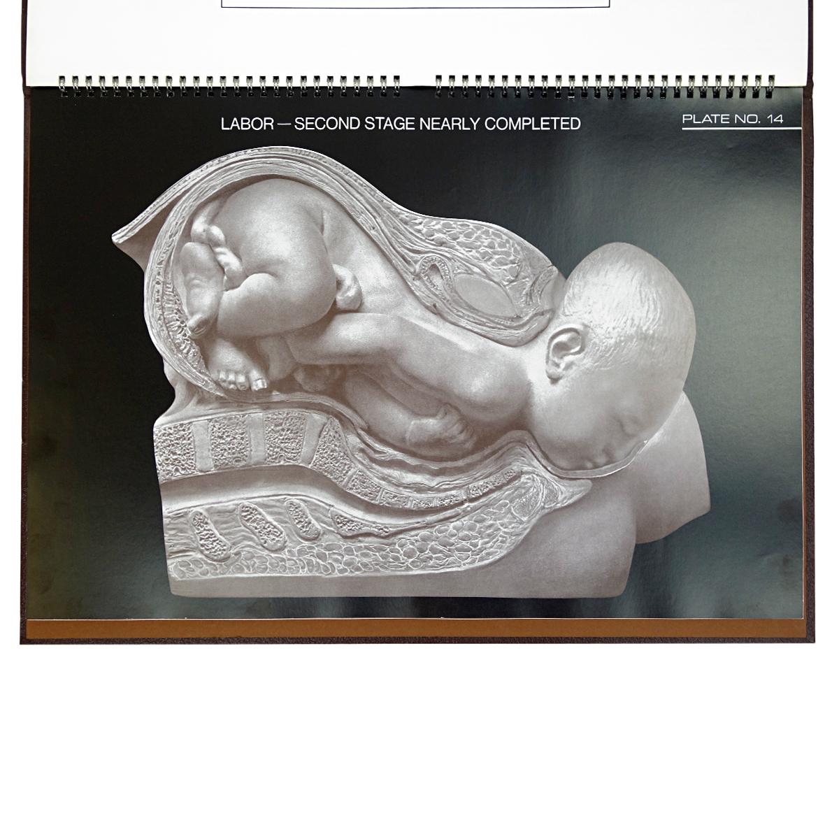 The Birth Atlas von der Maternity Center Association in New York 2