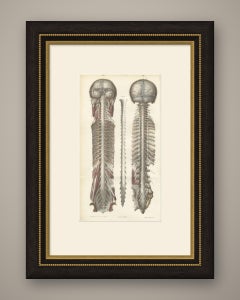 Brain and Spinal Cord in Situ, Hirschfeld Double Folding Plate, 1866