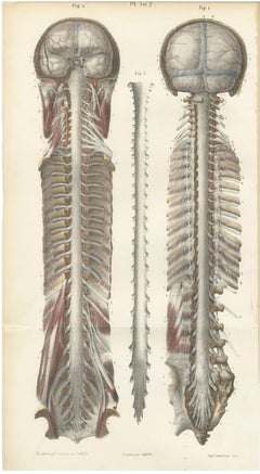 Brain and Spinal Cord in Situ, Hirschfeld Double Folding Plate, 1866