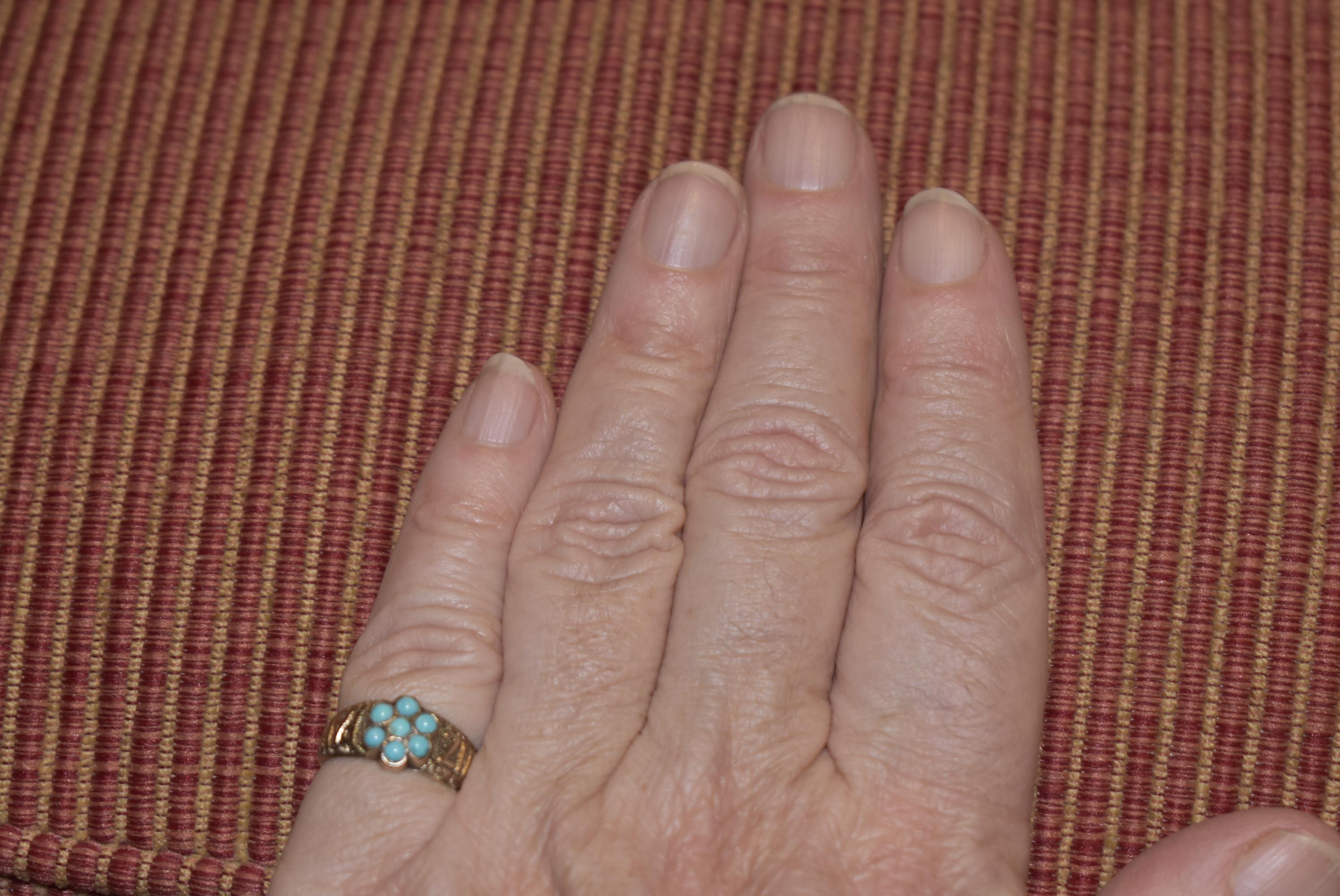 Cabochon 9k Turquoise Forget Me Not Mizpah Ring, circa 1880