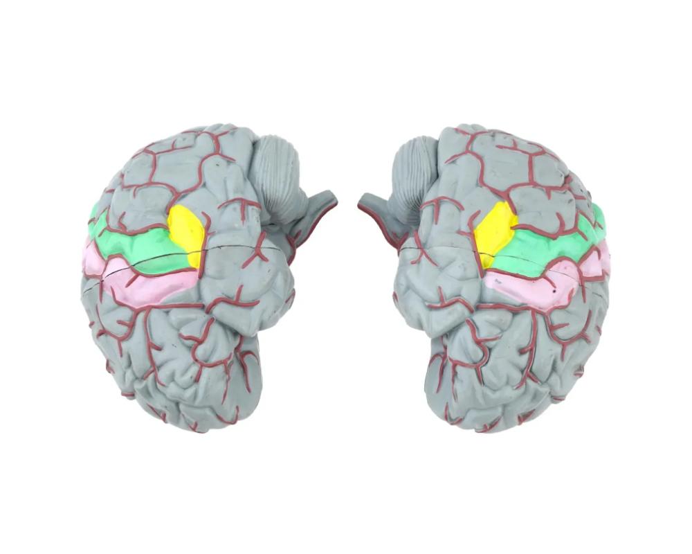 Canadian Life Size Model Of Human Brain By Gvssco In Good Condition In Long Island City, NY