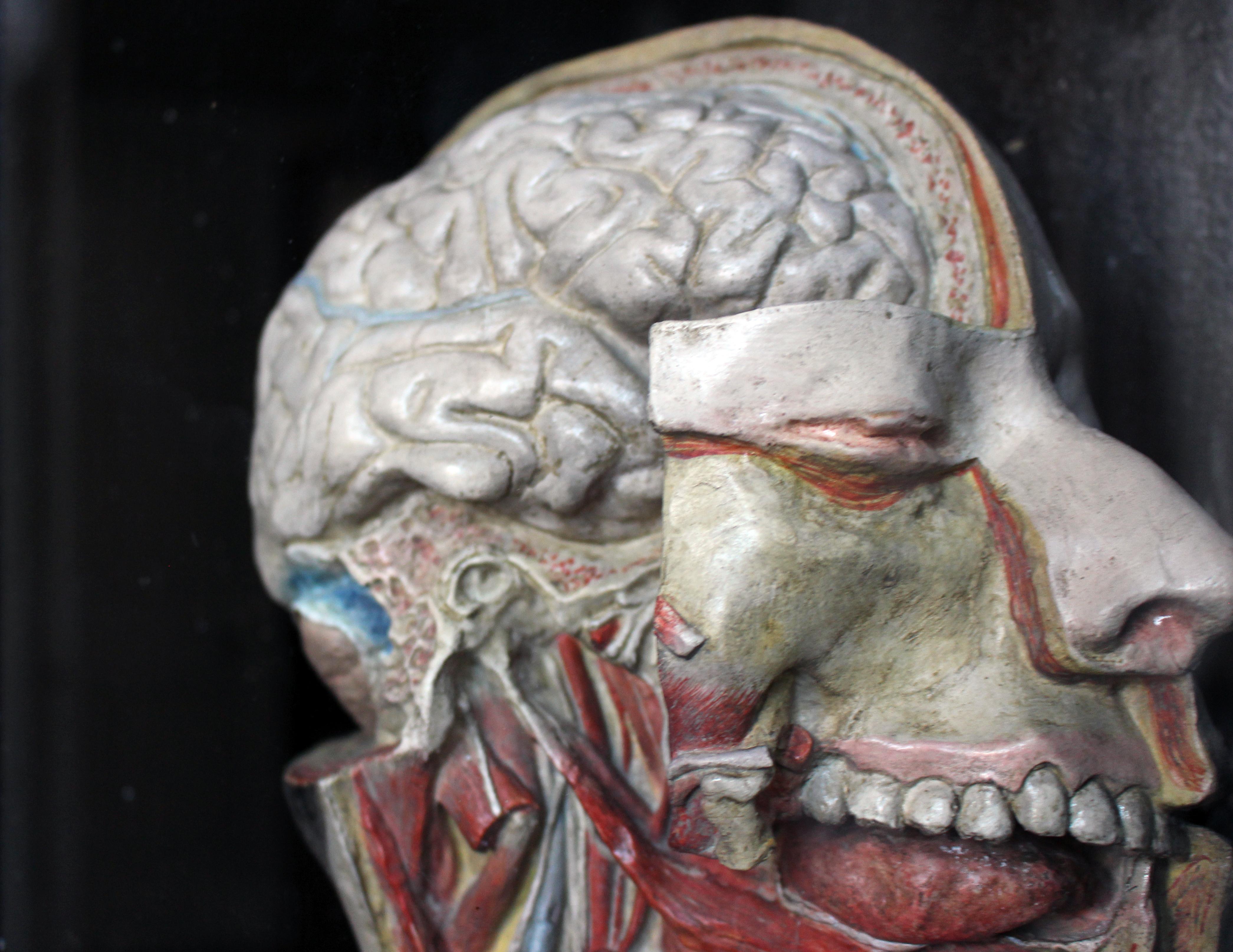 A 19th century scientific painted carved display of a cross section of a human skull mounted in a wooden box by A Nicholas.
 