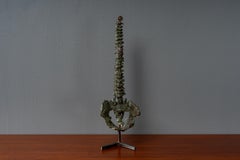 Cast Bronze Spinal Sculpture