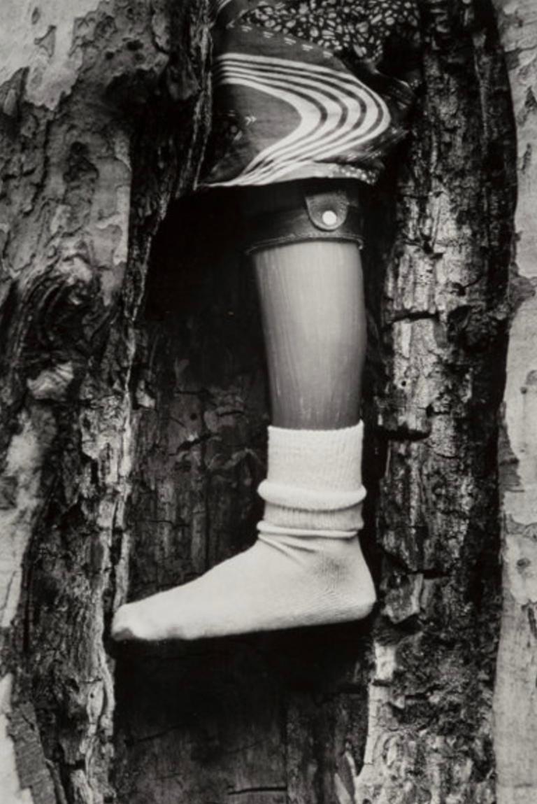 Chester Higgins  Black and White Photograph - Prosthetic Leg in Tree