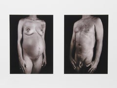 Chuck Close - print from Doctors of the World Portfolio, hand signed & numbered