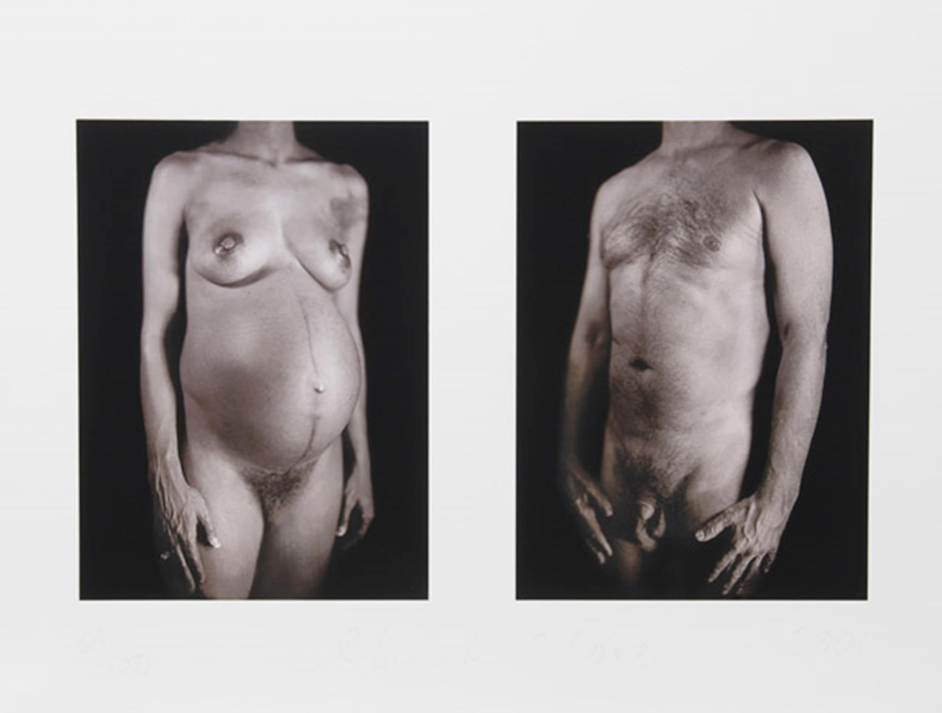 Nude Print Chuck Close - Untitled from Doctors of the World Portfolio, signé et numéroté Pop realism