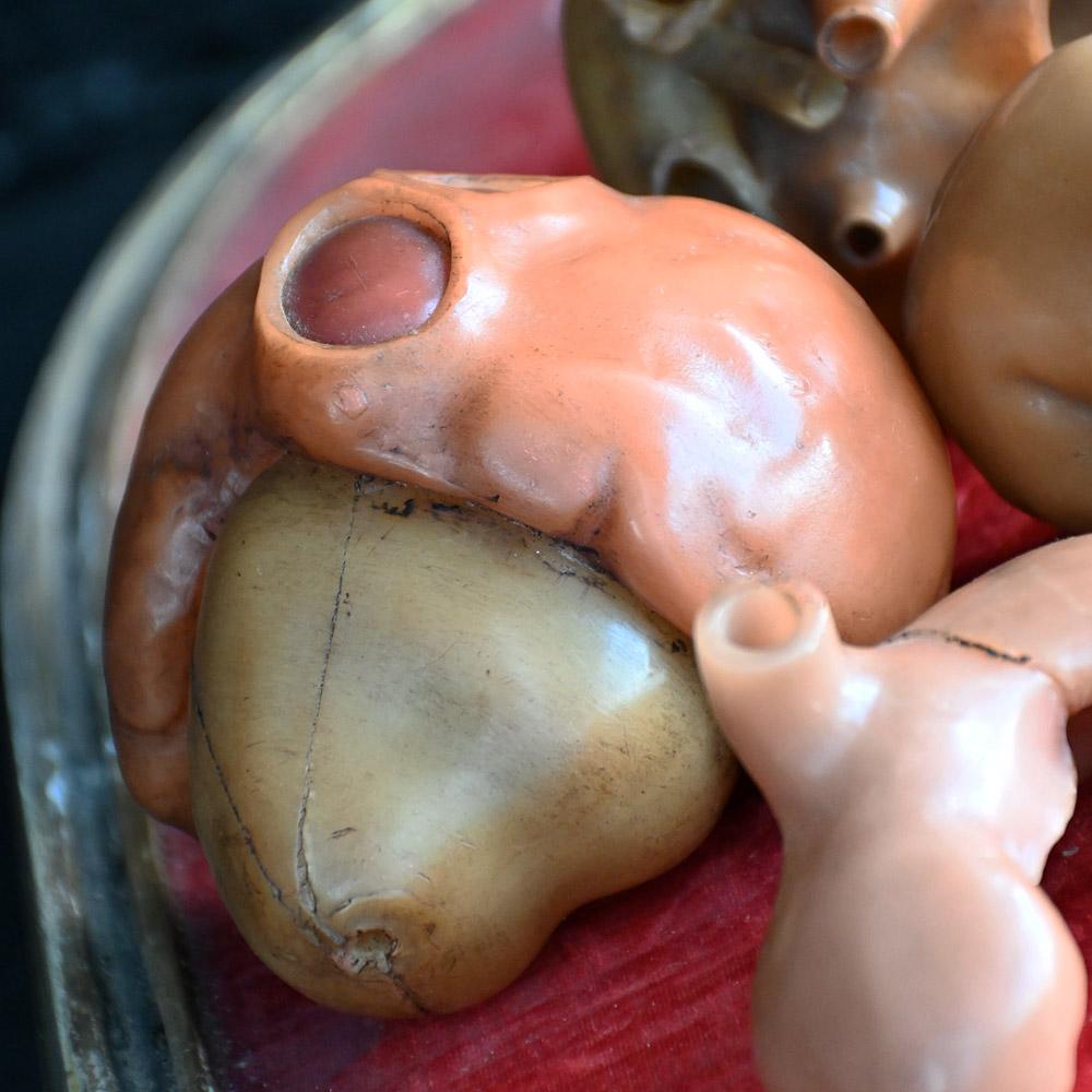 Collection of Friedrich Ziegler wax model human heart development forms For Sale 2
