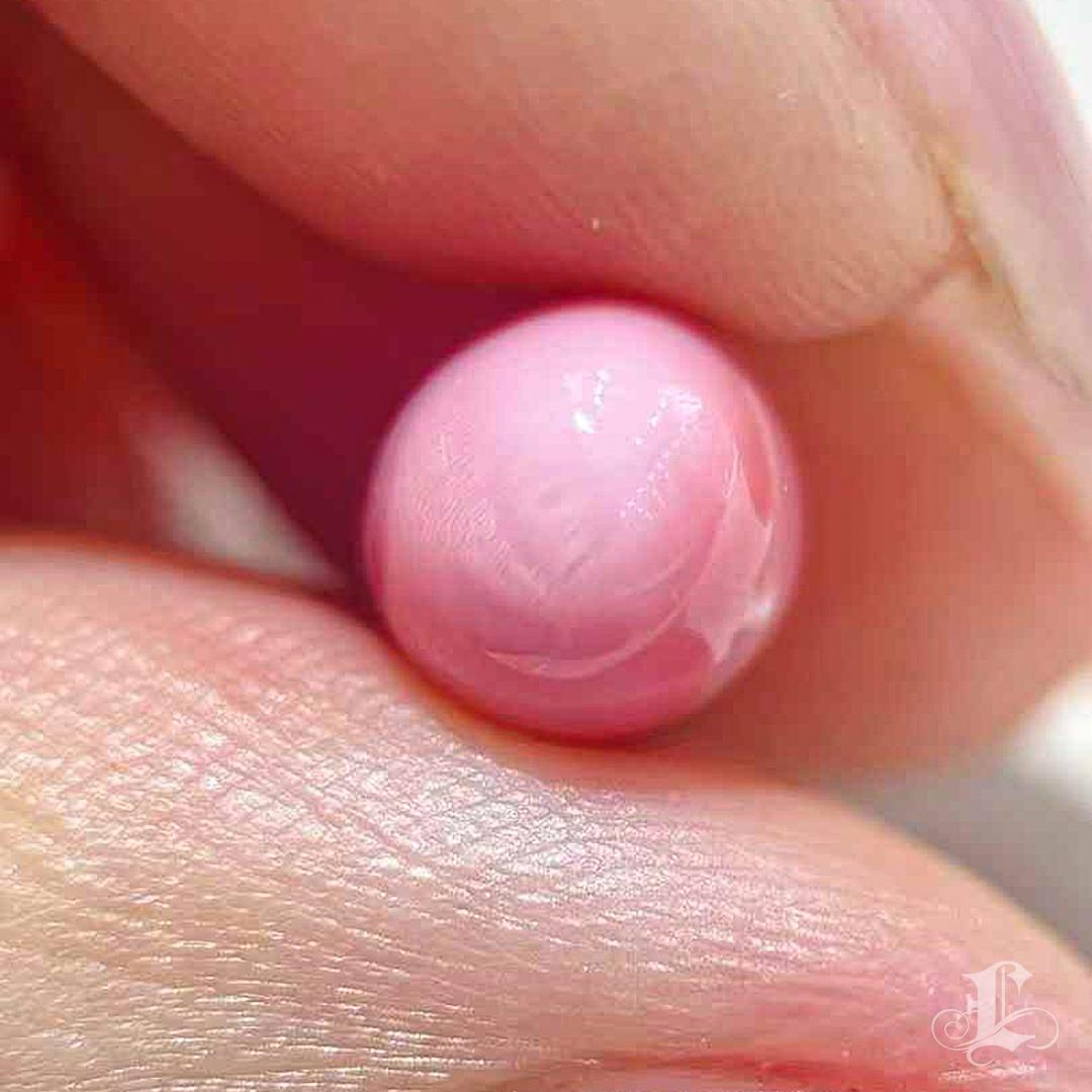 【Conchéa】Rosé Ember 6.95ct Loose Conch Pearl 3