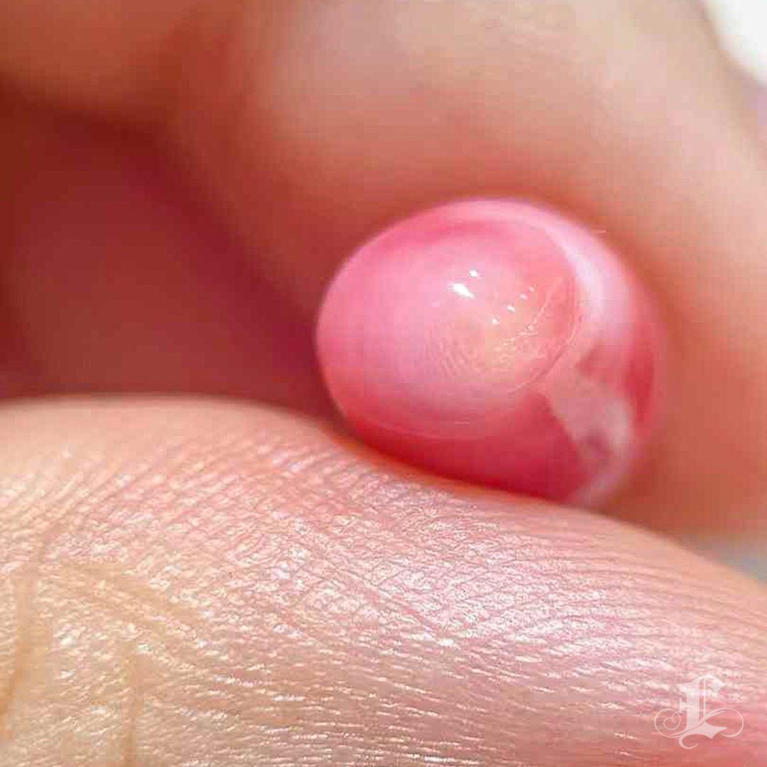 【Conchéa】Rosé Ember 6.95ct Loose Conch Pearl 4