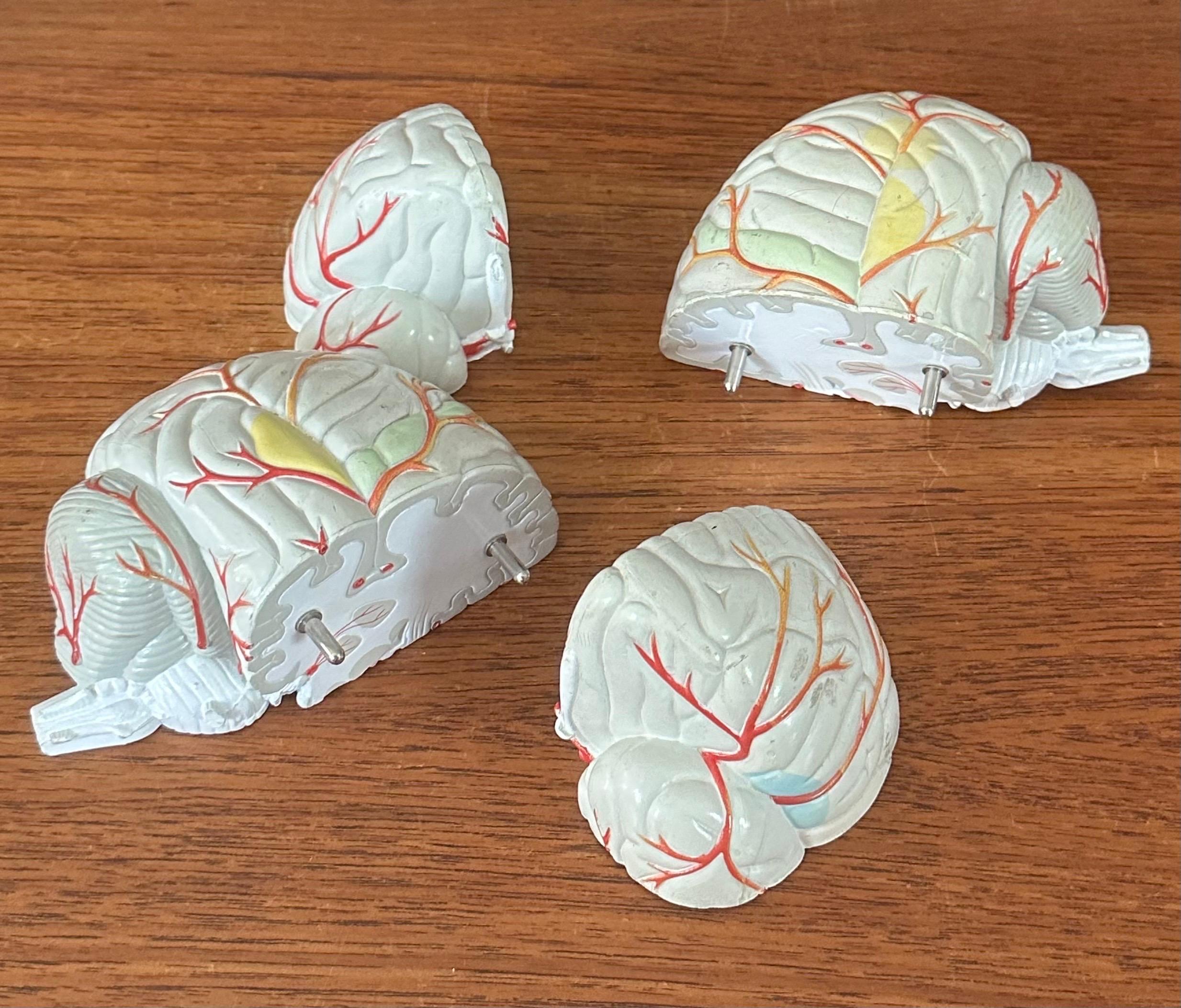 Modello di cervello farmaceutico contemporaneo con cranio in lucite in vendita 9