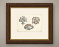 Coronal Section of the Head, Antique Hirschfeld Anatomy Print, 1866