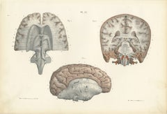 Coronal Section of the Head, Antique Hirschfeld Anatomy Print, 1866