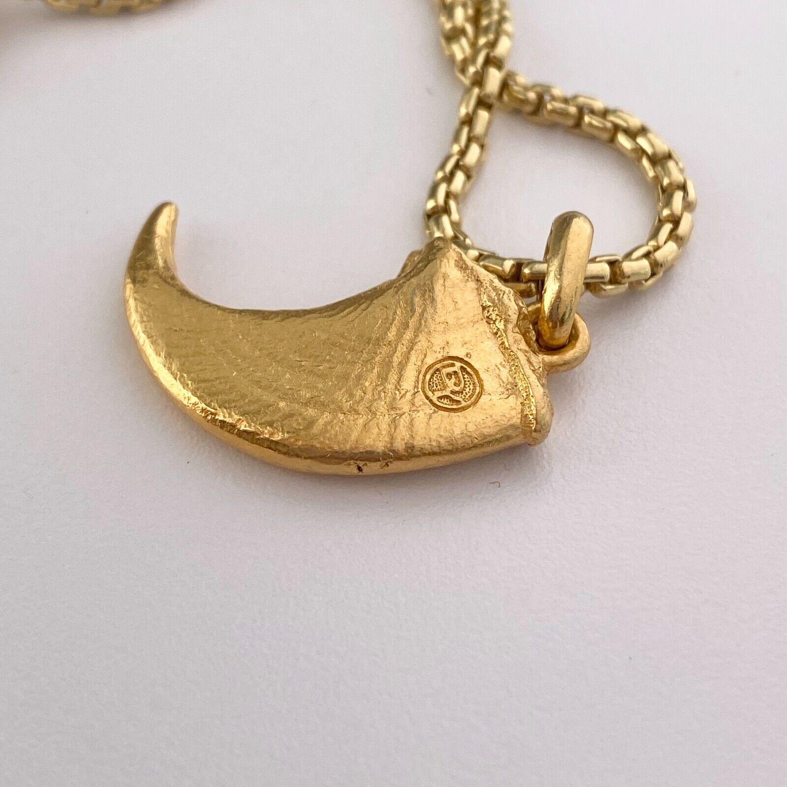 gold chain tooth